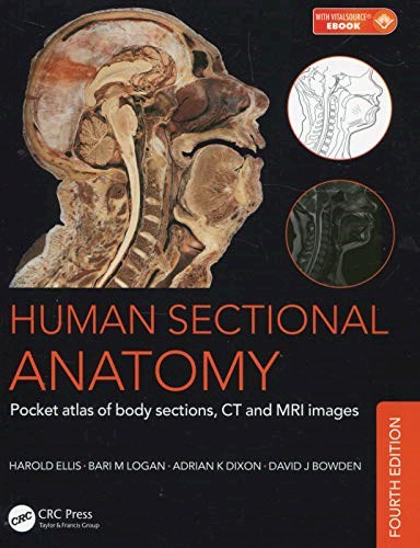 Papel Human Sectional Anatomy: Atlas of Body Sections, CT and MRI Images