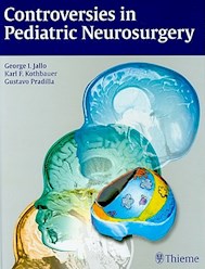 Papel Controversies In Pediatric Neurosurgery