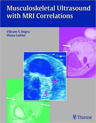 Musculoskeletal Ultrasound With Mri Correlations