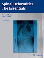 Papel Spinal Deformities Ed.2