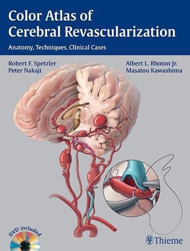 Papel Color Atlas of Cerebral Revascularization