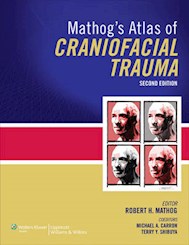 Papel Mathog'S Atlas Of Craniofacial Trauma Ed.2