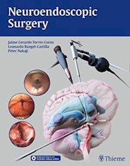 Papel Neuroendoscopic Surgery