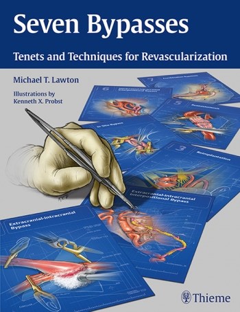 Papel Seven bypasses: tenets and techniques for revascularization