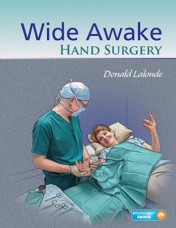 Papel Wide Awake Hand Surgery