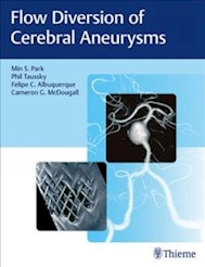 Papel Flow Diversion Of Cerebral Aneurysms