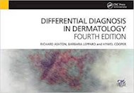 Papel Differential Diagnosis In Dermatology