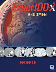 Papel Expert Differential Diagnoses: Abdomen
