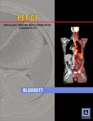 Papel Pet/Ct: Oncologic Imaging With Correlative Diagnostic Ct