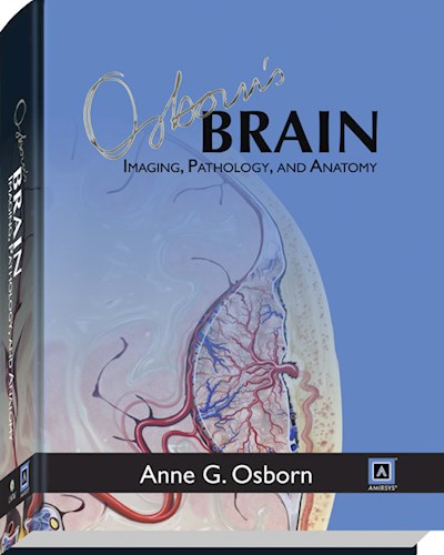 Papel Osborn Brain