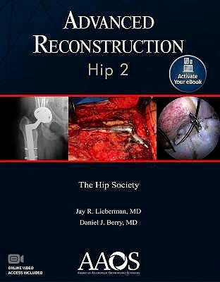 Papel Advanced Reconstruction: Hip 2