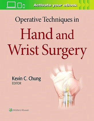 Papel Operative Techniques in Hand and Wrist Surgery
