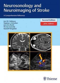 Papel Neurosonology and Neuroimaging of Stroke Ed.2