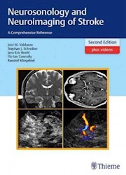 Papel Neurosonology And Neuroimaging Of Stroke Ed.2