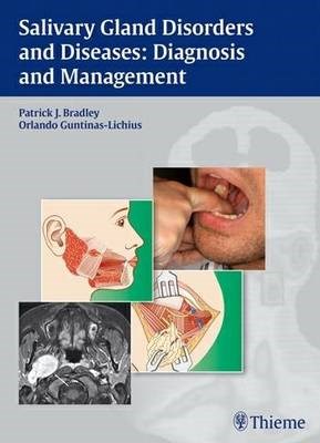 Papel Salivary Gland Disorders and Diseases