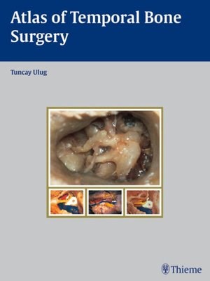 Papel Atlas of Temporal Bone Surgery