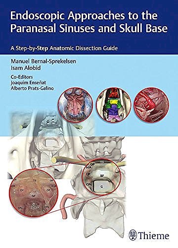 Papel Endoscopic Approaches to the Paranasal Sinuses and Skull Base