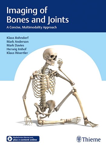 Papel Imaging of Bones and Joints