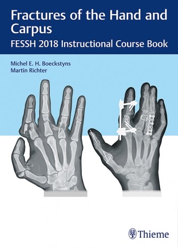 Papel Fractures of the Hand and Carpus