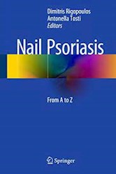 Papel Nail Psoriasis: From A To Z
