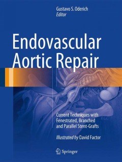 Papel Endovascular Aortic Repair: Current Techniques With Fenestrated, Branched and Parallel Stent- Grafts