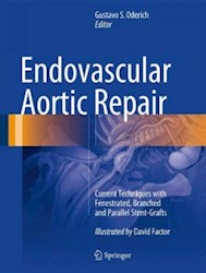 Papel Endovascular Aortic Repair: Current Techniques With Fenestrated, Branched And Parallel Stent- Grafts