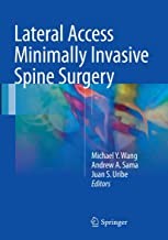 Papel Lateral Access Minimally Invasive Spine Surgery