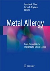 Papel Metal Allergy: From Dermatitis To Implant And Device Failure