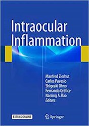 Papel Intraocular Inflammation
