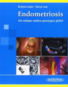 Papel ENDOMETRIOSIS UN ENFOQUE MEDICO QUIRURGICO GLOBAL