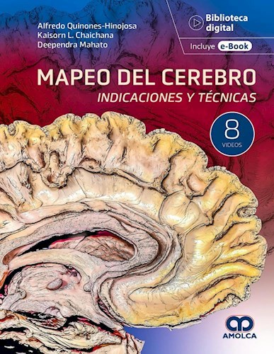 Papel Mapeo del Cerebro. Indicaciones y Técnicas