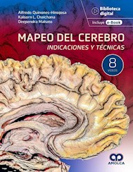 Papel Mapeo Del Cerebro. Indicaciones Y Técnicas