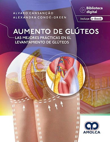Papel Aumento de Glúteos