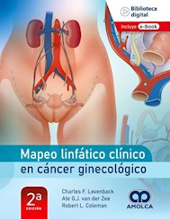 Papel Mapeo Linfático Clínico En Cáncer Ginecológico