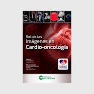 Papel Rol De Las Imágenes En Cardio-Oncología