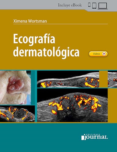 E-book Ecografía Dermatológica (eBook)