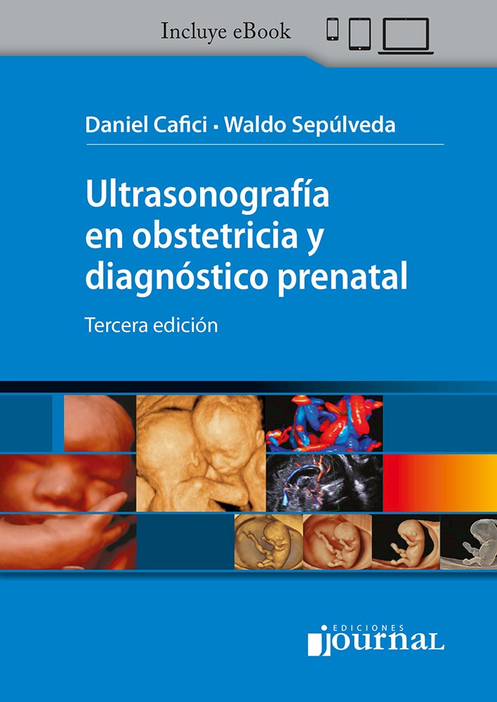 Papel Ultrasonografía En Obstetricia Y Diagnóstico Prenatal (Handbook) Ed.3 (Prox)