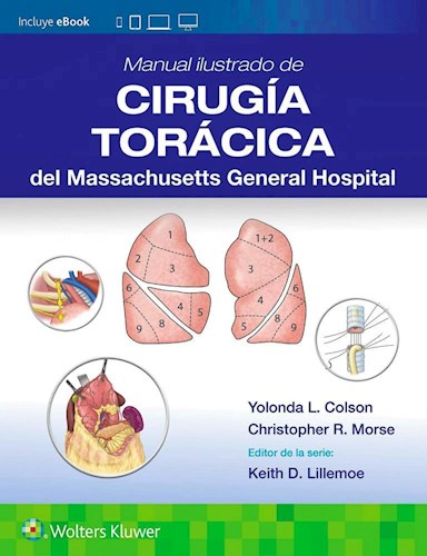 Papel Manual Ilustrado de Cirugía Torácica del Massachusetts General Hospital