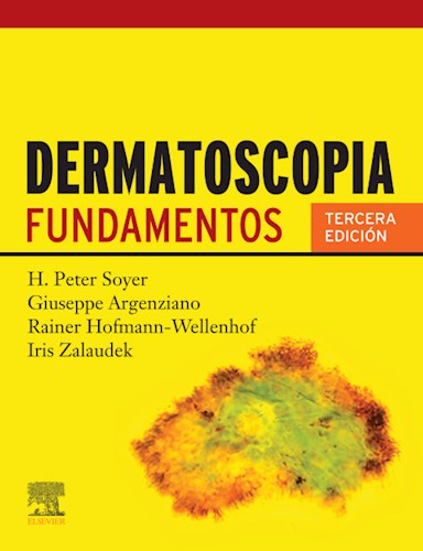 E-book Dermatoscopia Ed.3 (eBook)