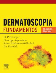 E-book Dermatoscopia Ed.3 (Ebook)