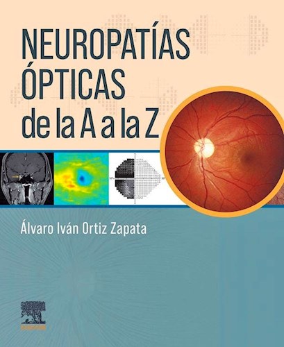 Papel Neuropatías Ópticas de la A a la Z