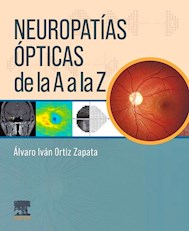 Papel Neuropatías Ópticas De La A A La Z