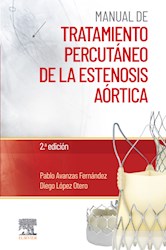 E-book Manual De Tratamiento Percutáneo De La Estenosis Aórtica
