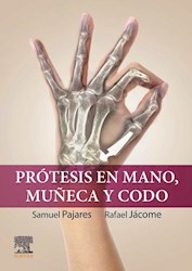 Papel Prótesis En Mano, Muñeca Y Codo