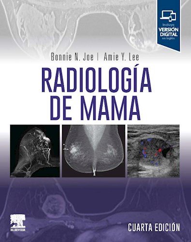 Papel Radiología de mama