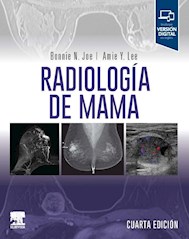 Papel Radiología De Mama
