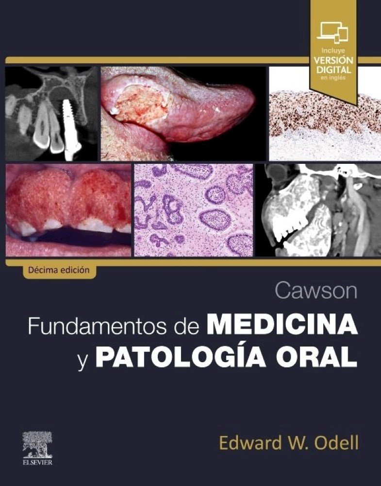 Papel Cawson. Fundamentos De Medicina Y Patología Oral Ed.10