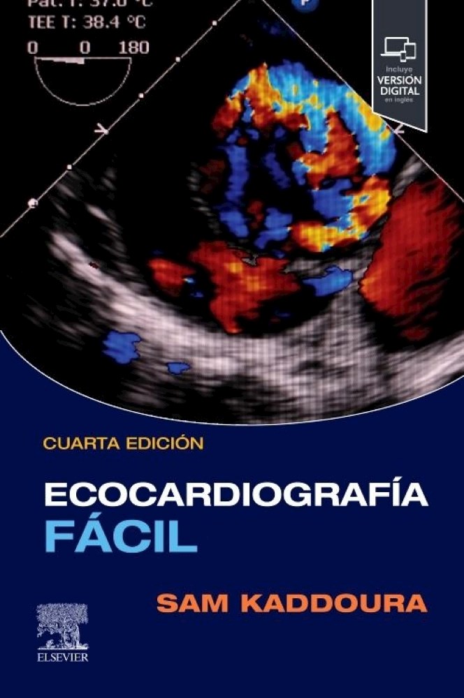Papel Ecocardiografía Fácil Ed.4