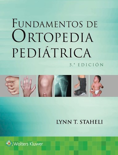 E-book Fundamentos de ortopedia pediátrica