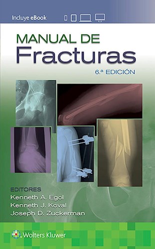 Papel Manual de Fracturas Ed.6